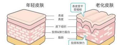 ​去除眼部皱纹最有效的办法是什么(眼部皱纹去除的小妙招)