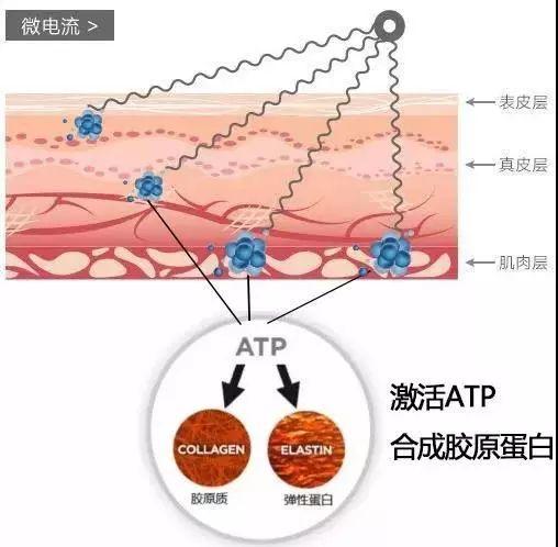 快速去皱去眼袋（有皱纹眼袋显老）(19)