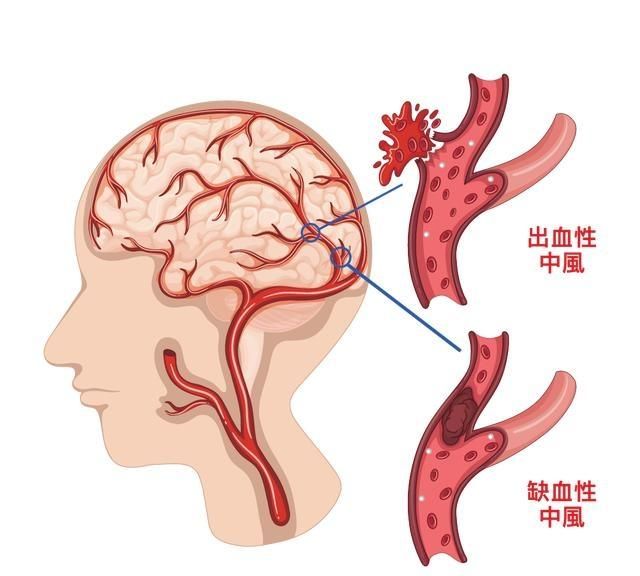 大暑吃什么风俗食物，大暑天吃什么食物好呢？图16