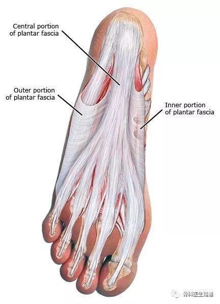 足底筋膜炎？你想知道的、该知道的，都在这